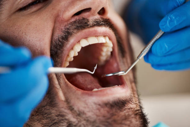 Best Emergency Dental Care for Sports Injuries in Mar Mac, NC