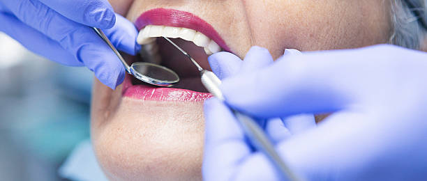 Best Emergency Root Canal Therapy in Mar Mac, NC